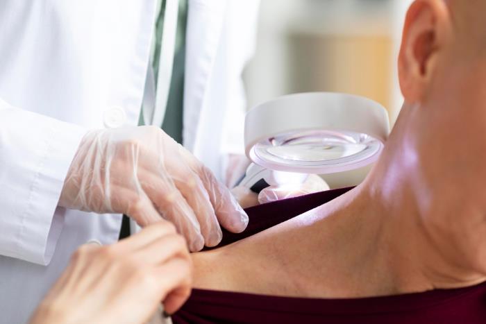 visita dermatologica pelle spalla paziente